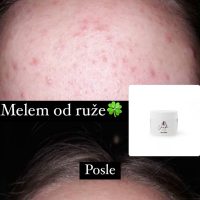 Recenzija ruža 1